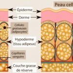 Comment battre la cellulite: les faits…